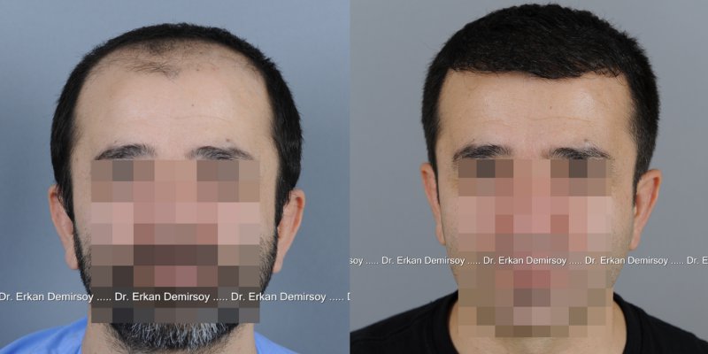 index.php/fa/14287/0/