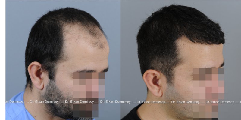 index.php/fa/14289/0/