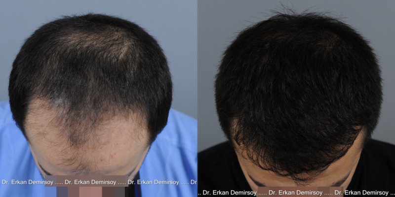 index.php/fa/14292/0/