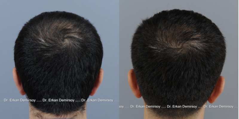 index.php/fa/14293/0/