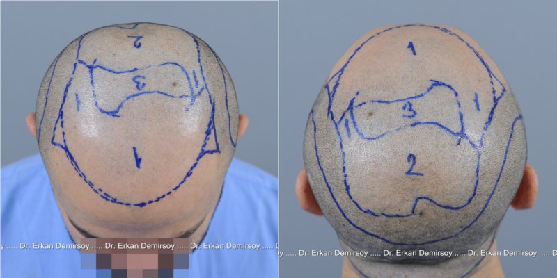 index.php/fa/14294/0/