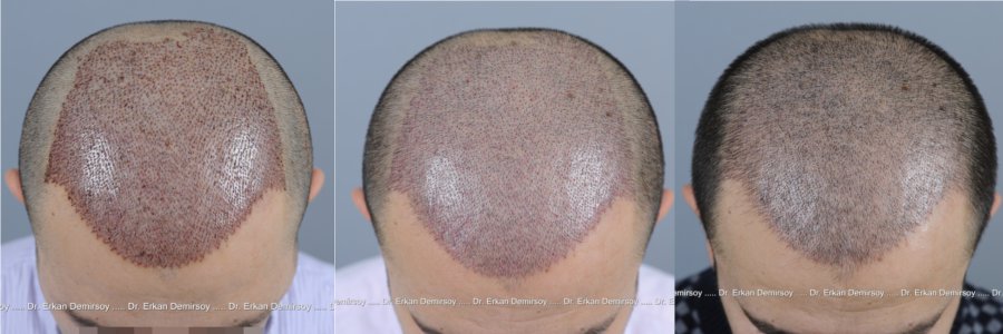 index.php/fa/14295/0/