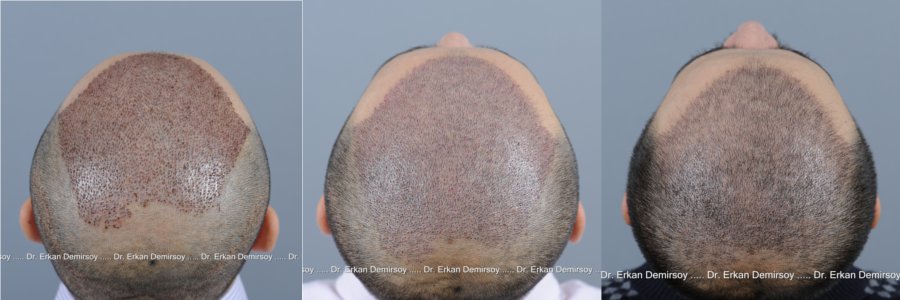 index.php/fa/14296/0/