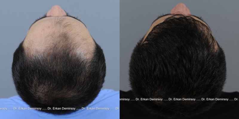 index.php/fa/14298/0/