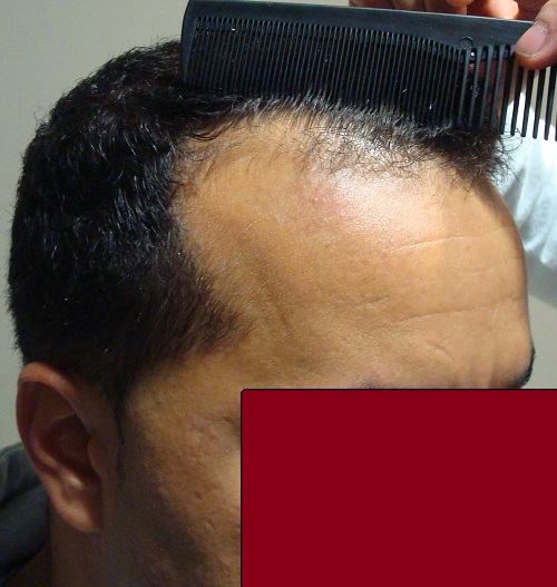 index.php/fa/14398/0/