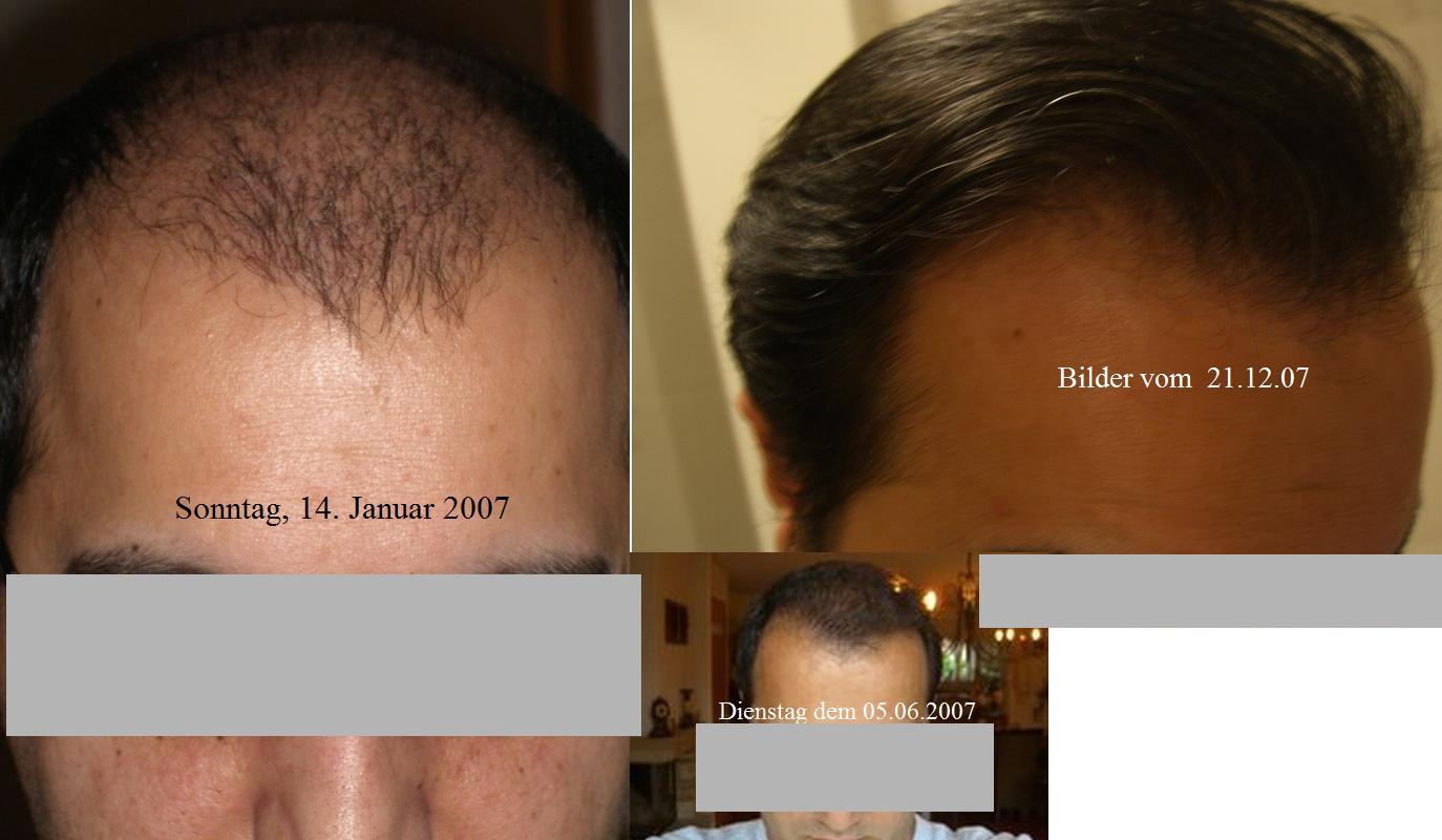 index.php/fa/1441/0/