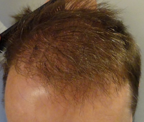 index.php/fa/14412/0/