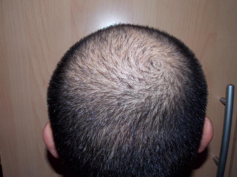 index.php/fa/14437/0/