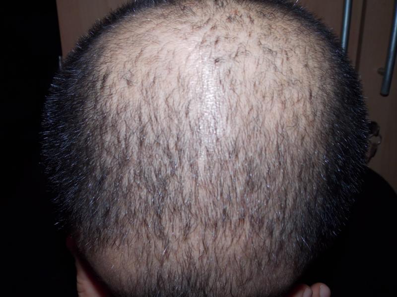 index.php/fa/14438/0/