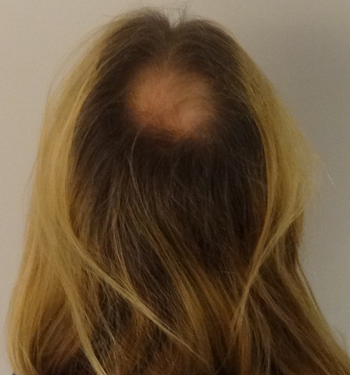 index.php/fa/14475/0/