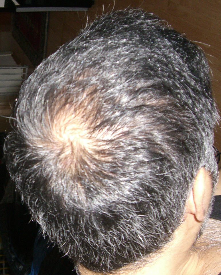 index.php/fa/14551/0/