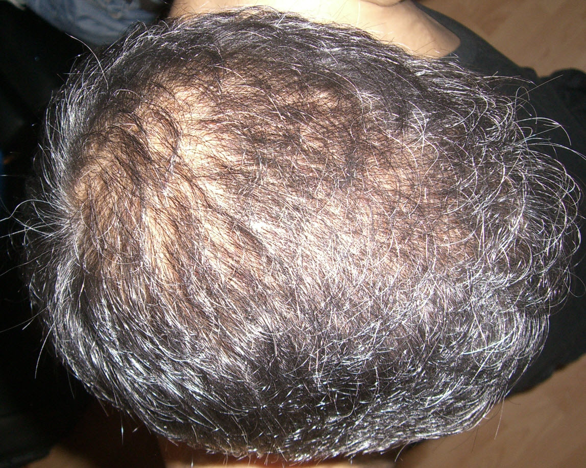 index.php/fa/14554/0/