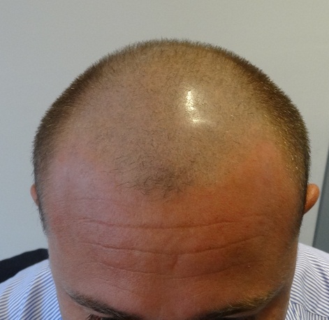 index.php/fa/14918/0/