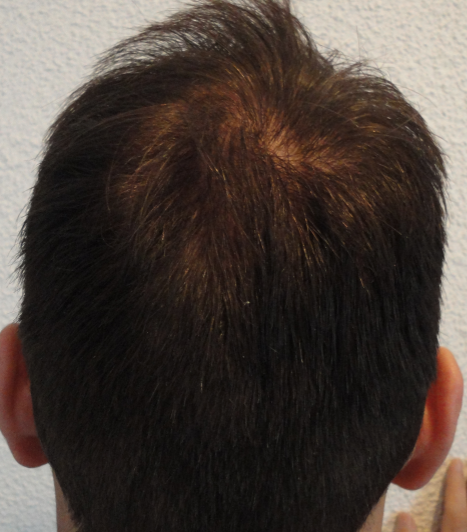 index.php/fa/15028/0/