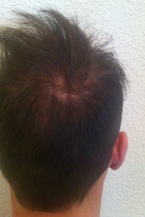 index.php/fa/15029/0/