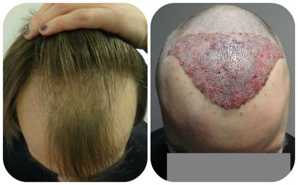 index.php/fa/15091/0/