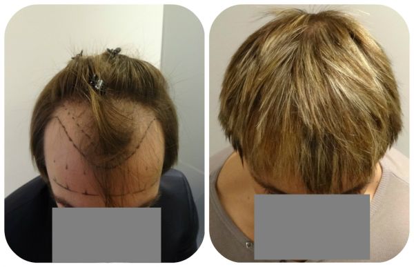 index.php/fa/15092/0/