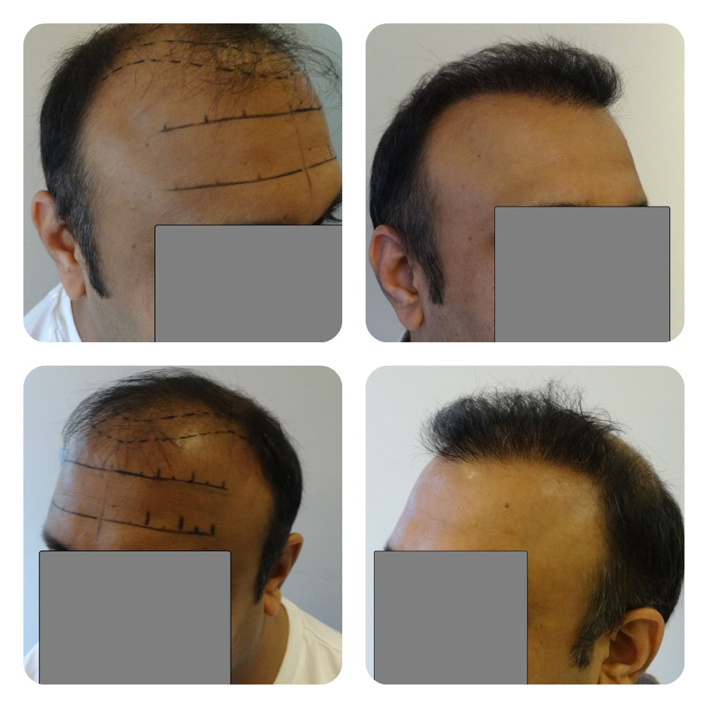 index.php/fa/15154/0/