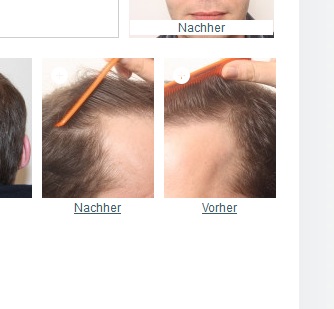 index.php/fa/15266/0/