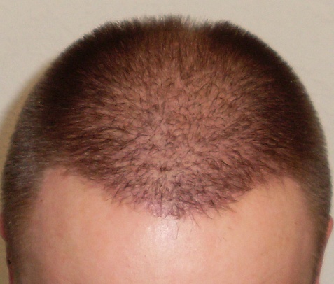 index.php/fa/15332/0/