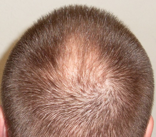 index.php/fa/15333/0/