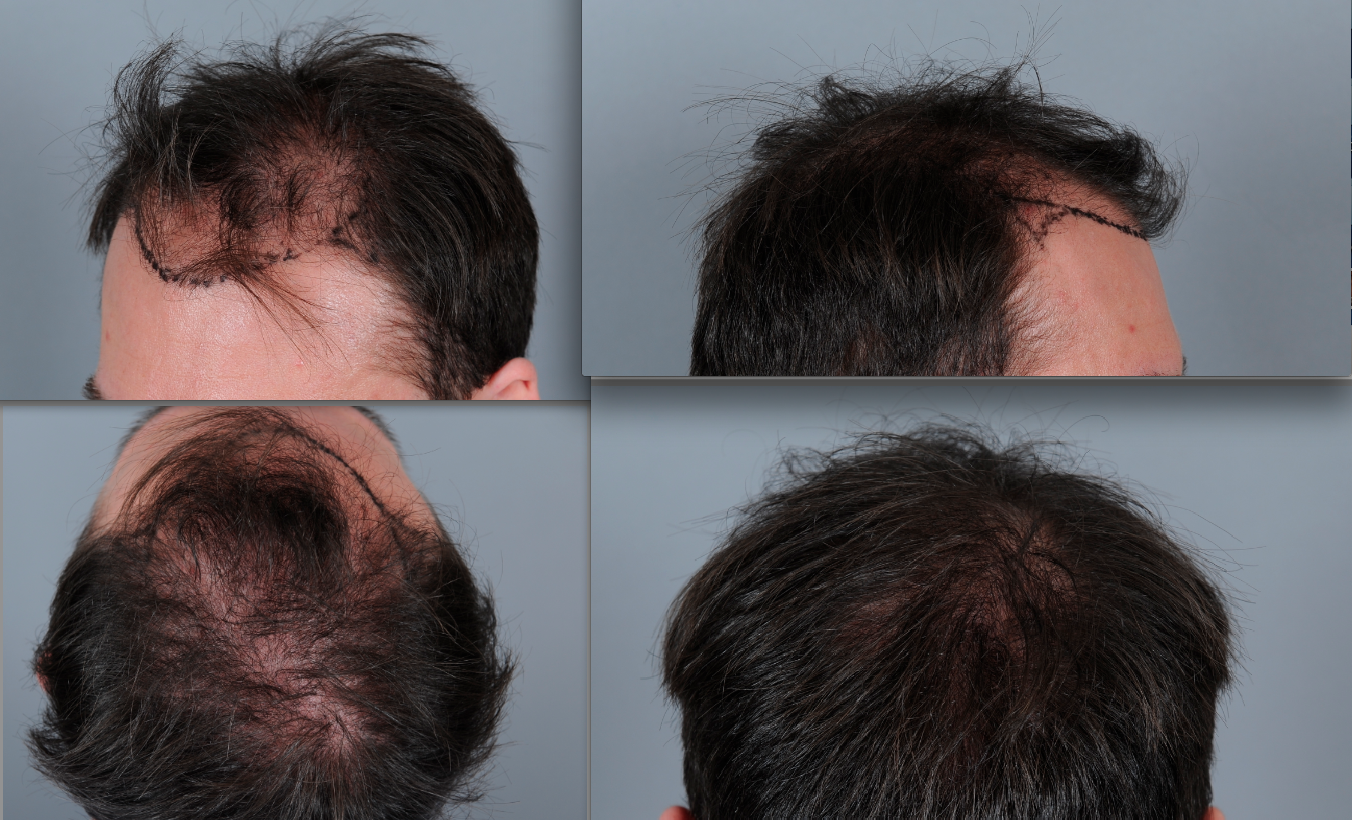 index.php/fa/15444/0/