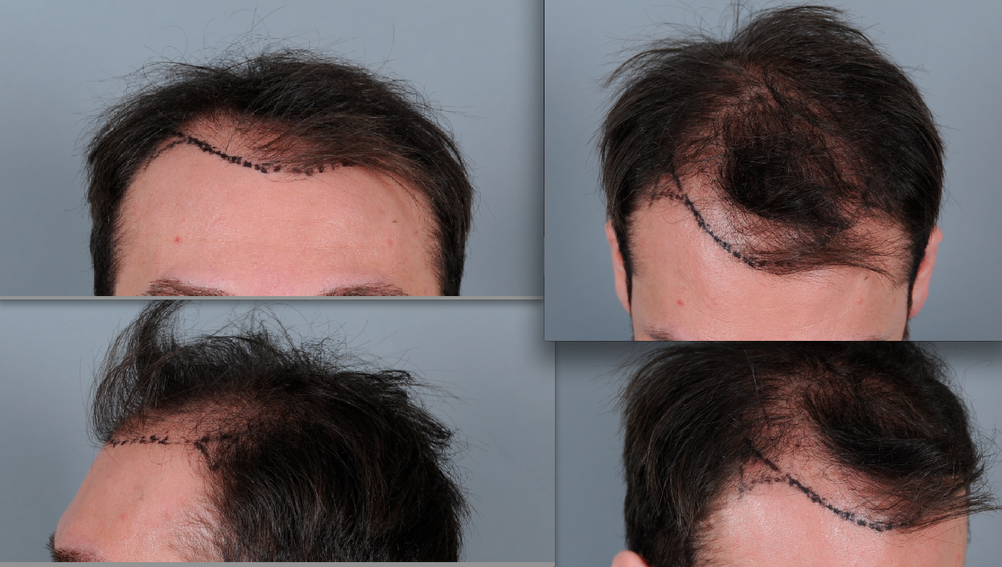 index.php/fa/15445/0/