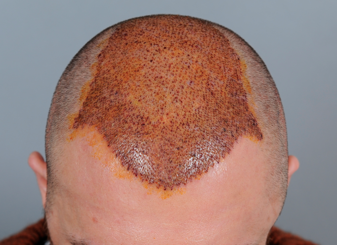 index.php/fa/15452/0/