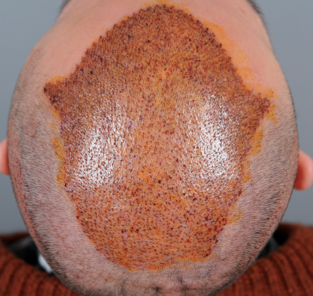 index.php/fa/15453/0/