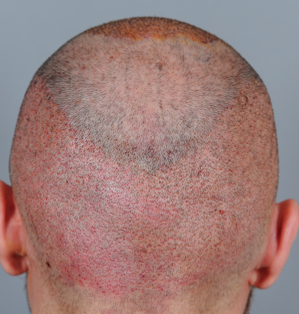 index.php/fa/15454/0/