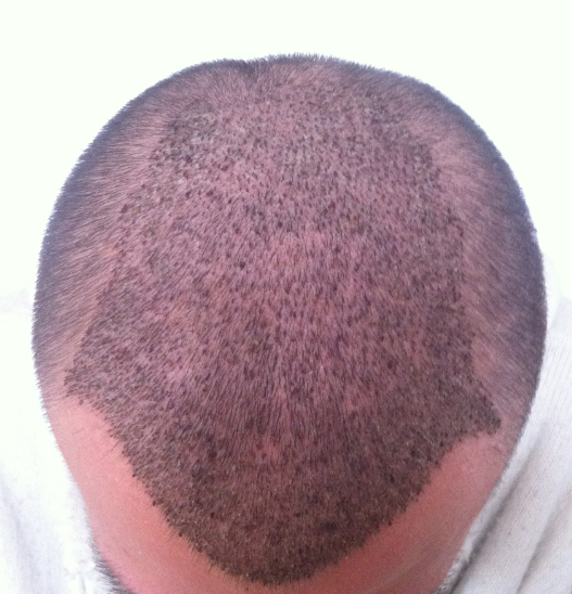 index.php/fa/15455/0/