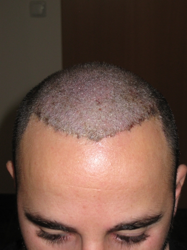 index.php/fa/15485/0/