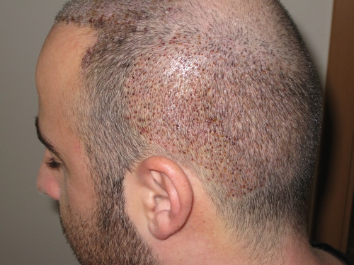 index.php/fa/15487/0/