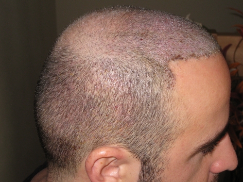 index.php/fa/15489/0/