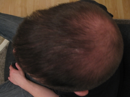 index.php/fa/15497/0/