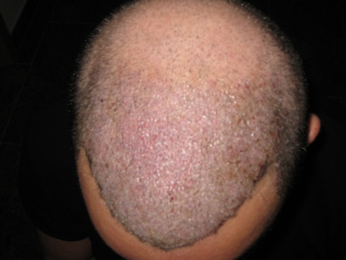 index.php/fa/15503/0/