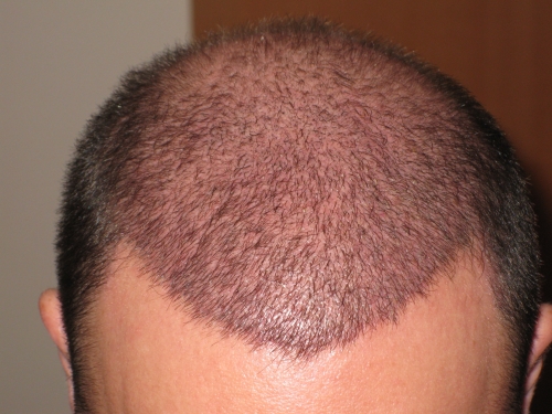 index.php/fa/15506/0/