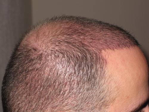 index.php/fa/15507/0/