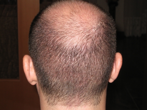 index.php/fa/15509/0/