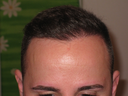 index.php/fa/15510/0/