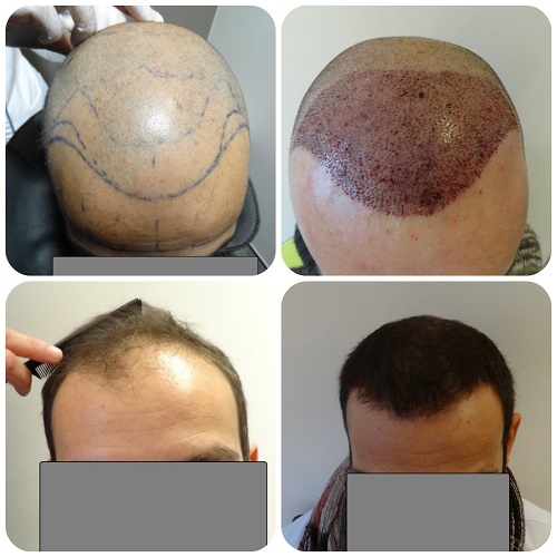 index.php/fa/15555/0/