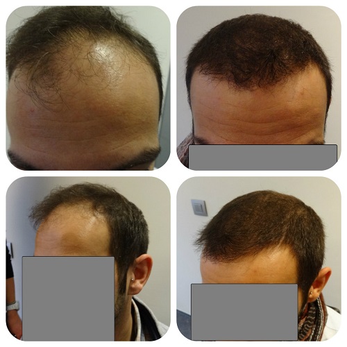 index.php/fa/15556/0/