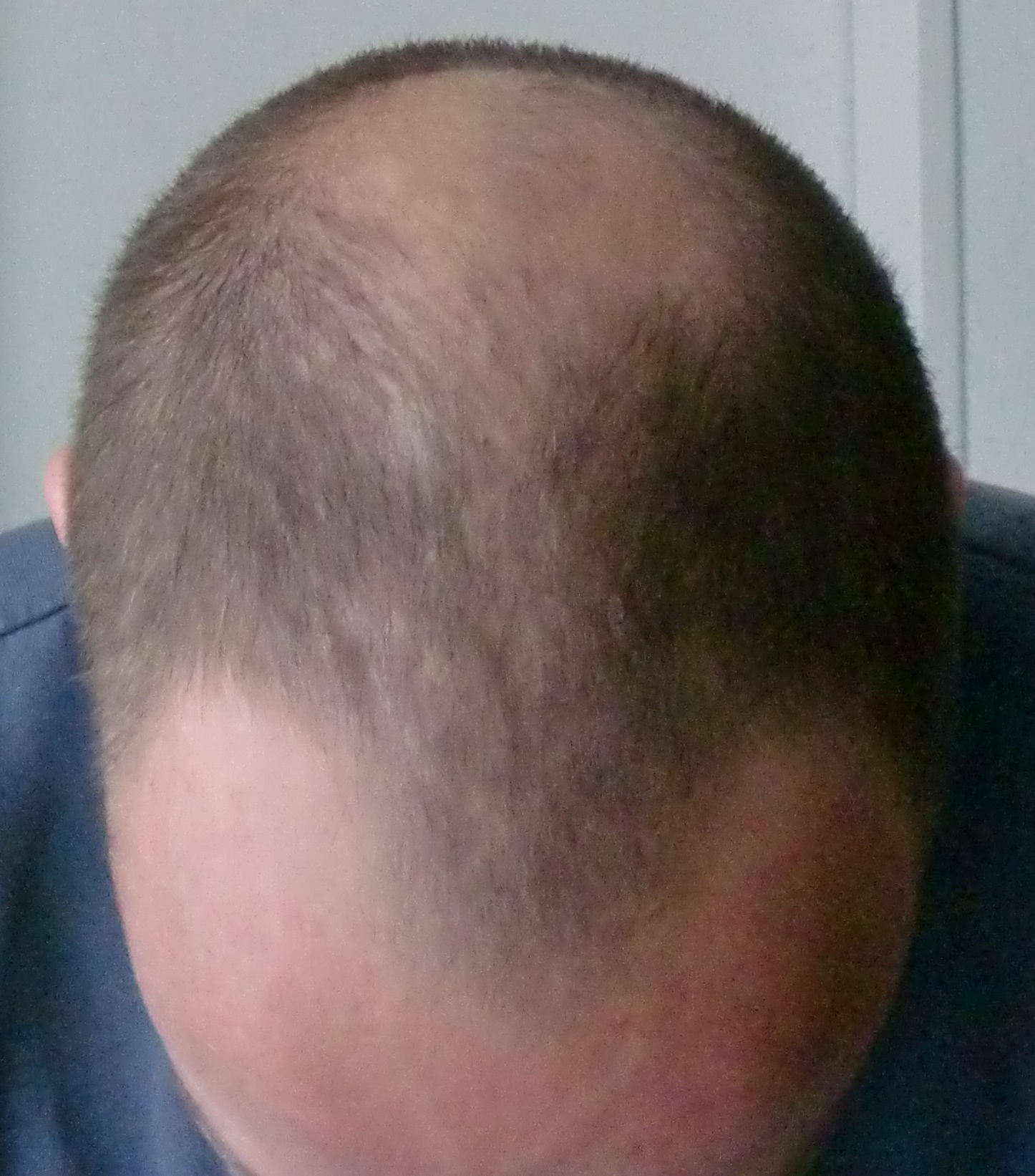 index.php/fa/15815/0/