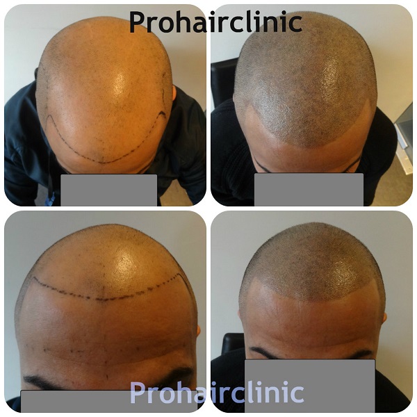 index.php/fa/15853/0/