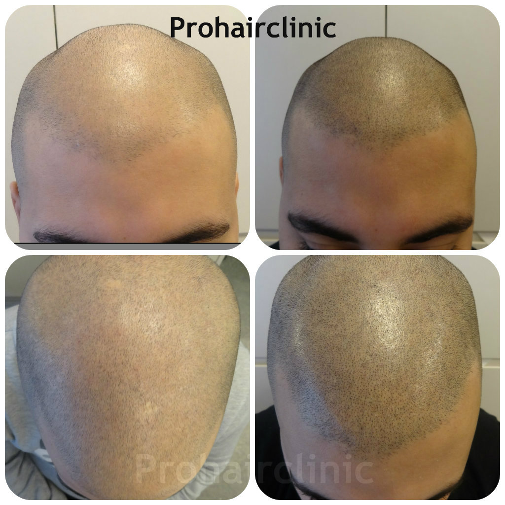 index.php/fa/15929/0/