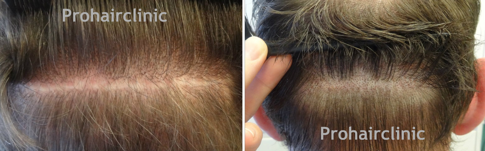 index.php/fa/16031/0/