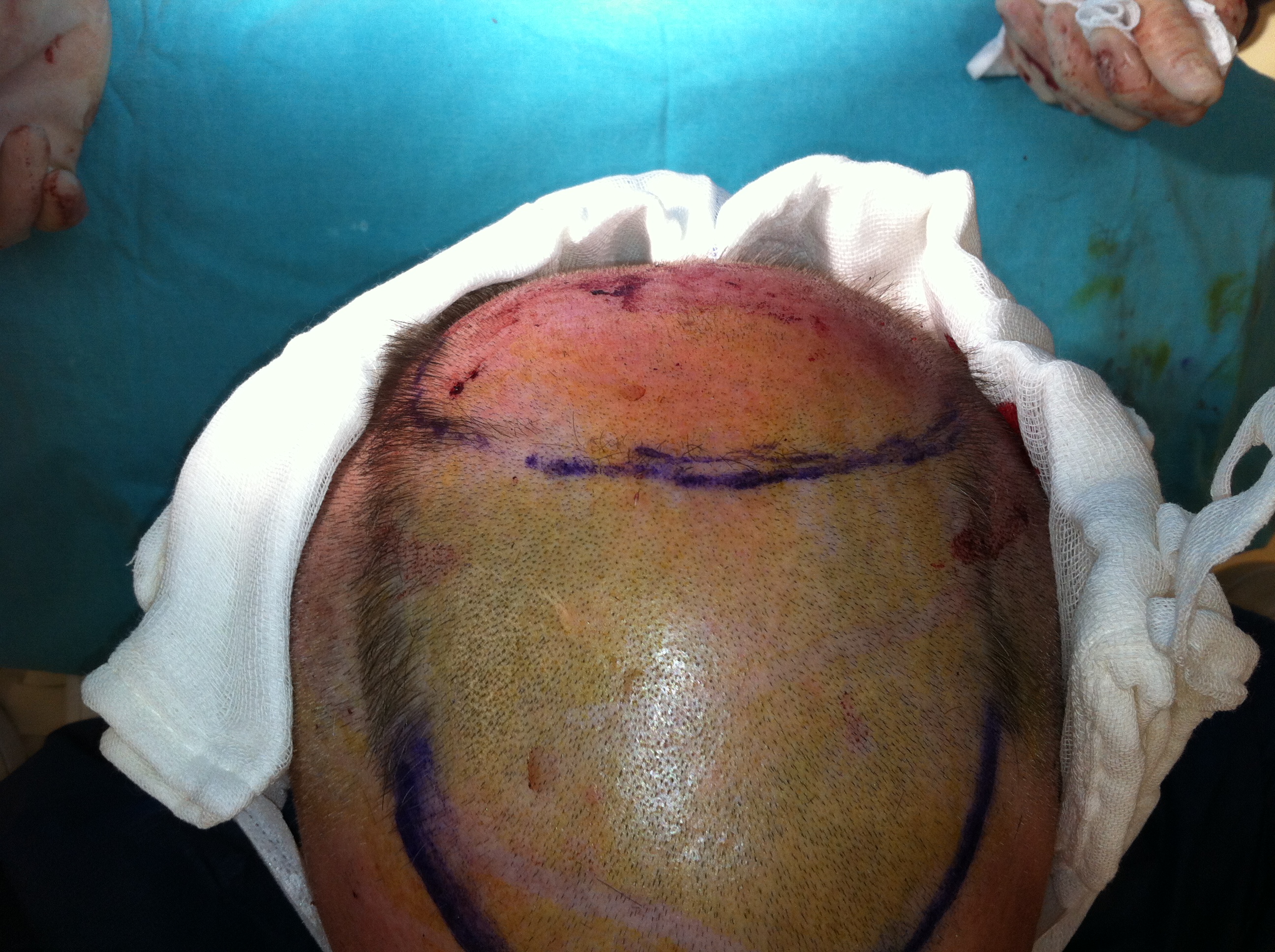 index.php/fa/16039/0/