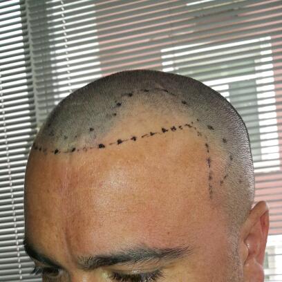 index.php/fa/16050/0/