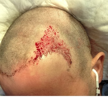 index.php/fa/16122/0/