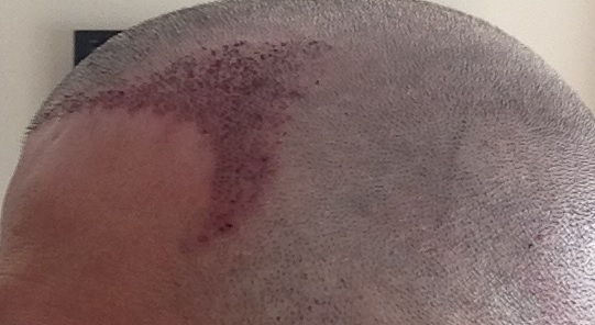 index.php/fa/16123/0/